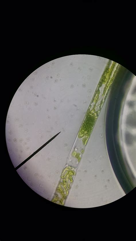 (400x)Spirogyra with smashed chloroplast structure. Same filament had ...