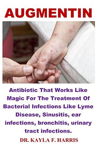 Buy Augmentin: Antibiotic That Works Like Magic For The Of Bacterial Infections Like Lyme ...