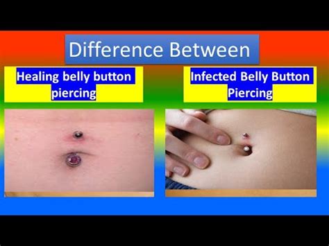 Distinction between Healing belly button piercing and Infected Belly ...