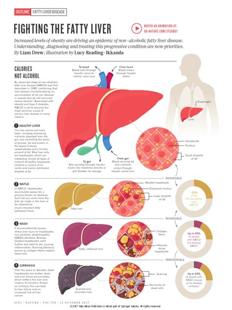 Fatty Liver | Liver | Obesity