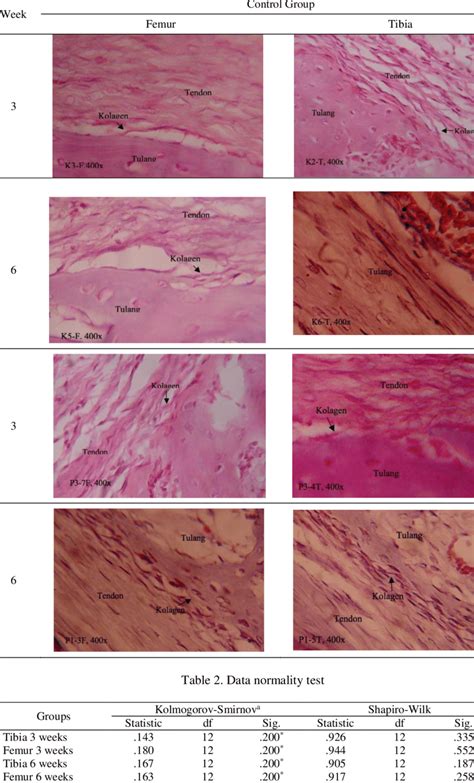 Histology of sharpey fiber thickness | Download Scientific Diagram