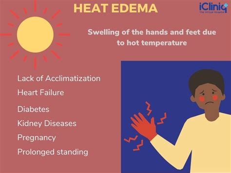 Heat Edema | Types | Causes | Risk Factors | Symptoms | Diagnosis