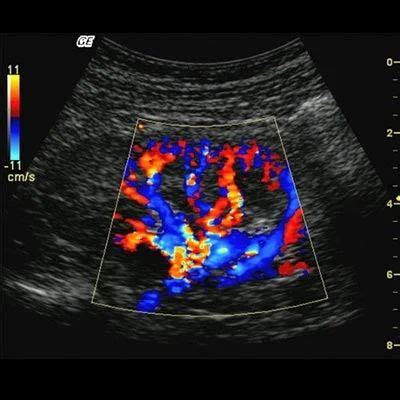 Color Doppler at best price in Thane by Dr. Dhanahris Sonography Clinic ...