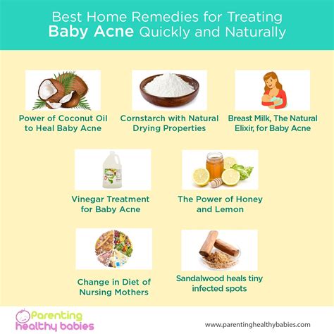 Ultimate Guide for Treating Baby Acne Naturally: Home Remedies