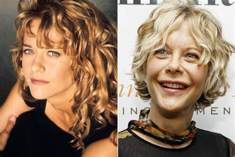 Meg Ryan before and after plastic surgery (9) – Celebrity plastic ...