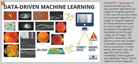 How artificial intelligence can transform eye care