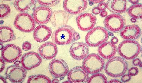 Lab 1 Neurohistology - Nerves