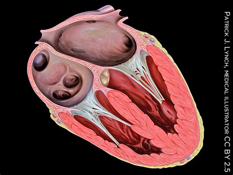 Combined Tricuspid, Mitral Valve Repair Linked to Better Outcomes ...