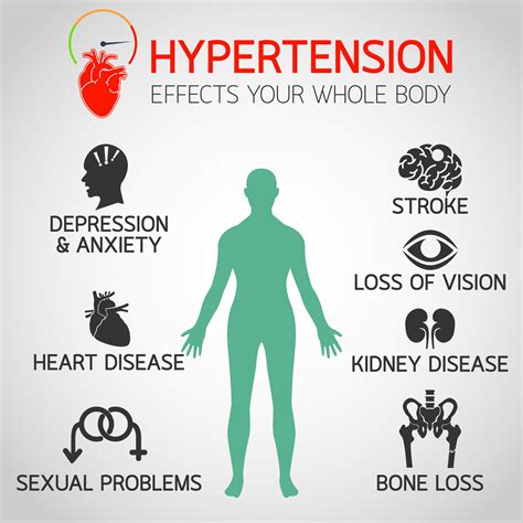 Hypertension: Symptoms and Causes - Pulse Cardiology