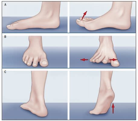 Professor Hylton B Menz: Foot exercises for hallux valgus?