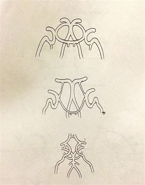 Circle of Willis Variations Diagram | Quizlet