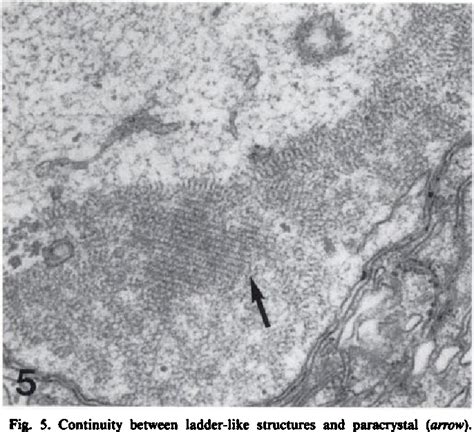 Figure 5 from Snail neurons as a possible model for testing neurotoxic ...