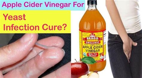 How To Use Apple Cider Vinegar For Yeast Infection? - Ostomy Lifestyle