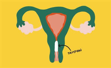 Hole Diagram How To Insert A Tampon Ilustración De Cómo Us