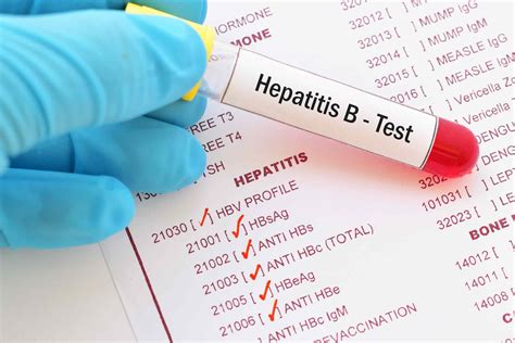 ¿Cómo me hago la prueba de hepatitis B/VHB? - Medicina Básica