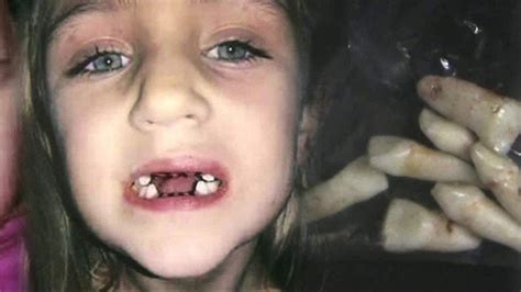 Dentist Accused of Performing Unwanted Procedures, Abusing Children | wnep.com