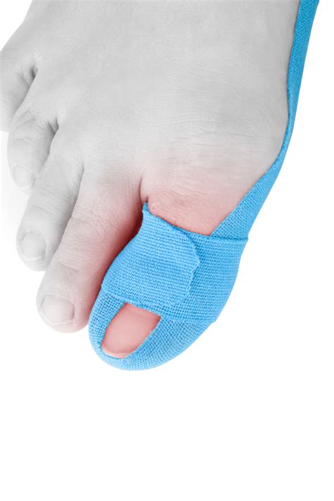 Health Hack: How to Treat a Broken Toe at Home | University of Utah Health