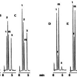 Reactivity of Bence Jones proteinuria assay antisera in the urine ...