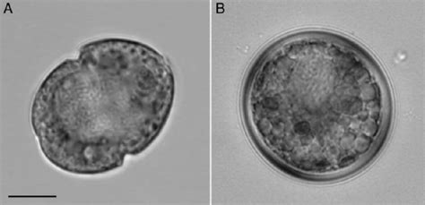 Scrippsiella hangoei. Light micrographs of (A) a flagellate cell and... | Download Scientific ...