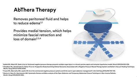 3M™ Abthera™ Therapy on the 3M™ V.A.C.® Ulta 4 Therapy System - YouTube