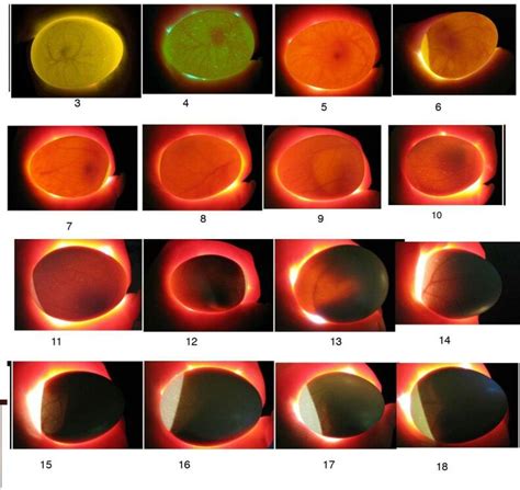 Embryo growth chart | Chickens backyard, Egg candling, Candling chicken ...