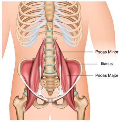 Iliopsoas Tendinopathy/Bursitis - Ultrasound Guided Injections