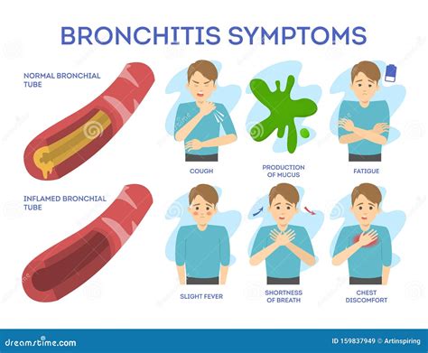 Bronchitis Symptoms Set. Chronic Disease Stock Vector - Illustration of ...