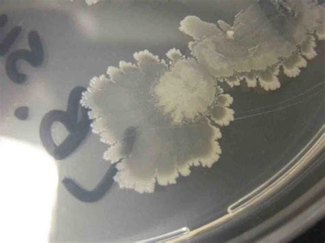 Bacillus Morphology