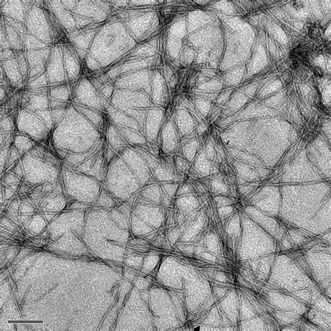 Image of the Week: Photoluminescent amyloid fibrils - Scope