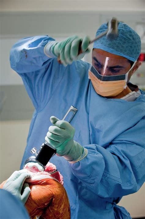 Knee Replacement Surgery Photograph by Jim Varney/science Photo Library - Fine Art America