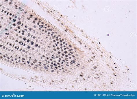 Mitosis Cell In The Root Tip Of Onion Under A Microscope. Royalty-Free Stock Photo ...