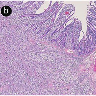 (a) Macroscopic image of small bowel resection (arrows indicate Several... | Download Scientific ...