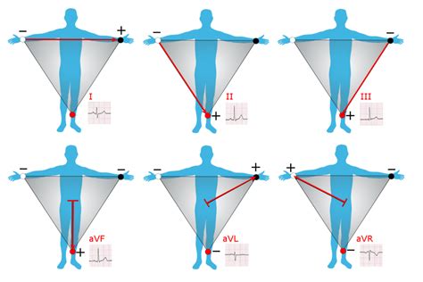 Medicine:Einthoven's triangle - HandWiki