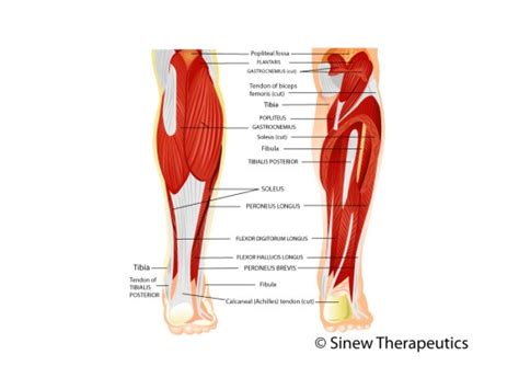 Peroneal Tendinopathy Tendinitis Information - Sinew Therapeutics