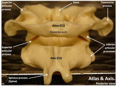 Atlas C1 and Axis C2 vertebrae, posterior view with labels… | Flickr