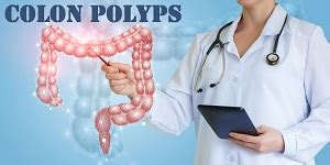 Colon Polyps - Causes, Treatment and Prevention.