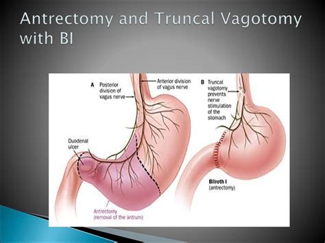 Clinical anatomy of abdominal cavity - презентация онлайн