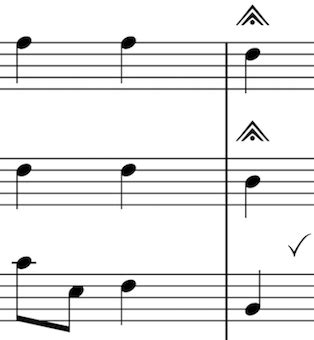 Changes to fermatas on single staves