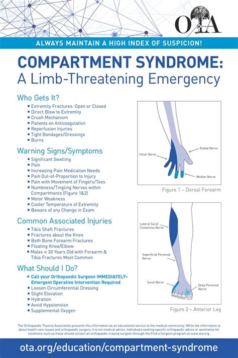 Compartment Syndrome Diagram