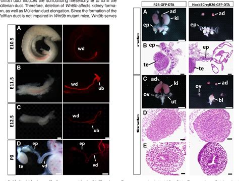 Figure 1 from Preformed Wolffian duct regulates Müllerian duct elongation independently of ...