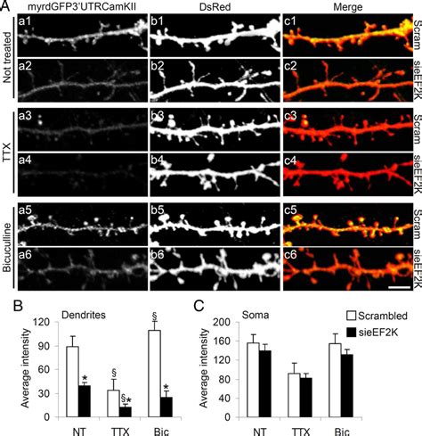 eEF2 phosphorylation by eEF2K regulates local protein synthesis. A,... | Download Scientific Diagram