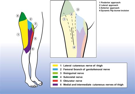 Medial Femoral Cutaneous Nerve Entrapment / Top Tips For Meralgia Paresthetica Chiroup ...