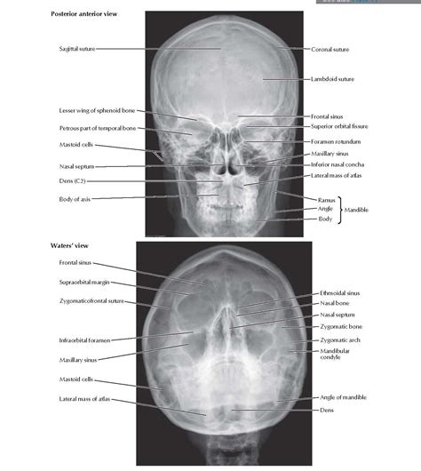 Skull X Ray Positioning Chart