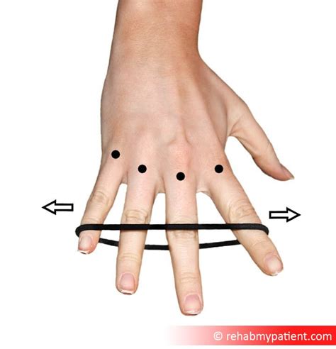 Flexor Tendon Injuries | Rehab My Patient