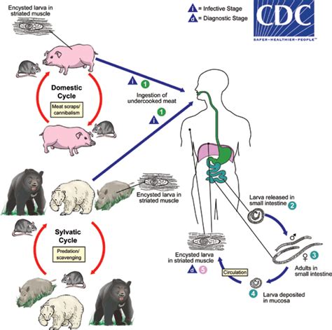 Trichinellosis - Biology | Biology, Medical laboratory science, Parasite