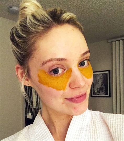 This Viral DIY Turmeric Mask Cured My Dark Under-Eye Circles for Real | Turmeric mask, Dark ...