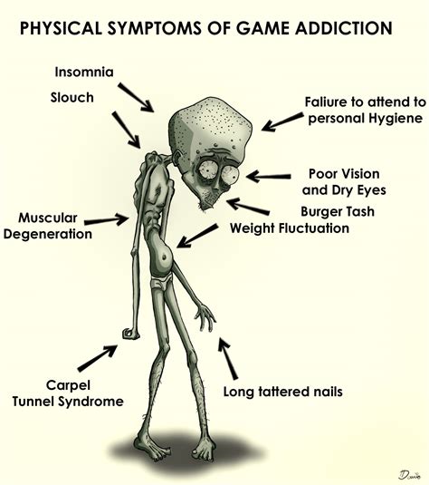 Seriousness of Games: Physical symptoms of game addiction