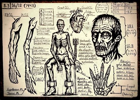 Wendigo Transformation Sequence (P. 3) : darkestdungeon