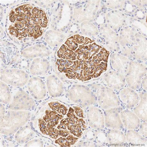 Anti-Nephrin antibody (ab85379) | Abcam