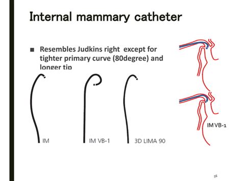 Diagnostic catheters for coronary angiography